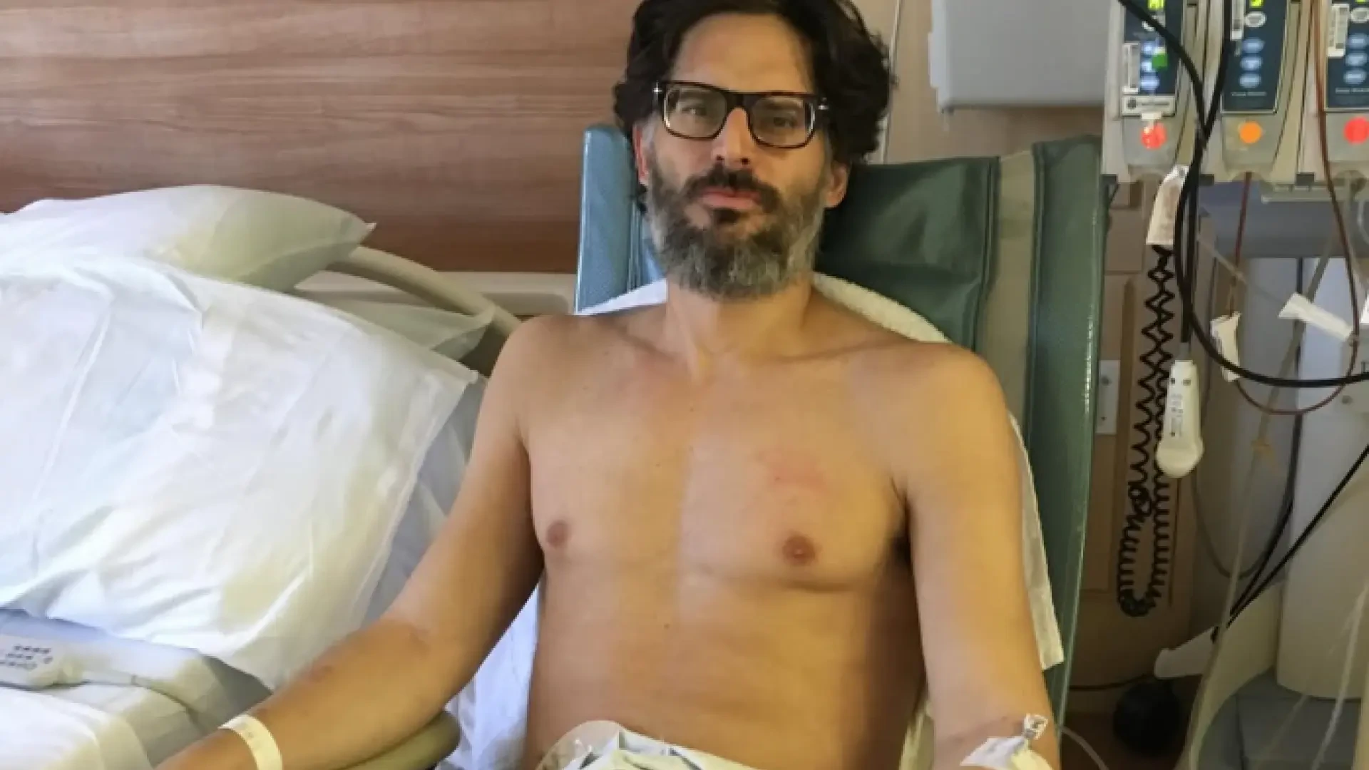 Joe Manganiello, 'Mr 0' en 'One Piece', muestra cómo le extirparon el intestino grueso: "Perdí 27 kilos en dos semanas"
